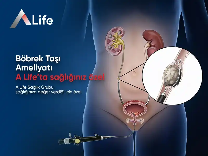 Böbrek Taşı Ameliyatı | Böbrek Taşı Ameliyatı Nasıl Yapılır?